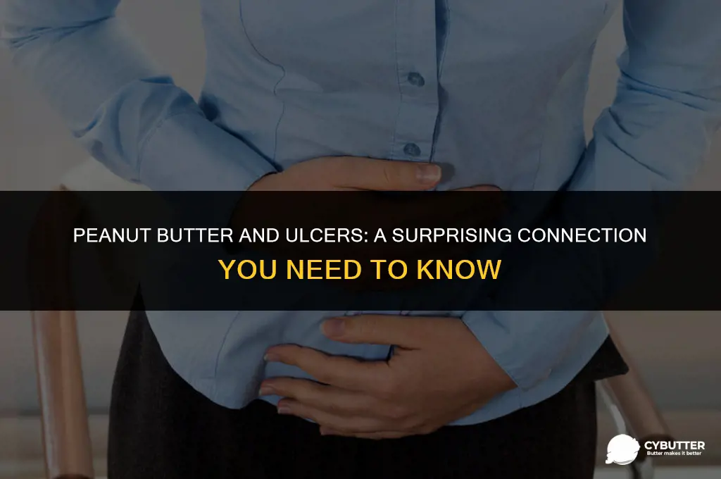 is peanut butter okay for ulcers