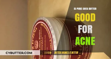 Pure Shea Butter for Acne: Benefits, Uses, and Effectiveness Explained