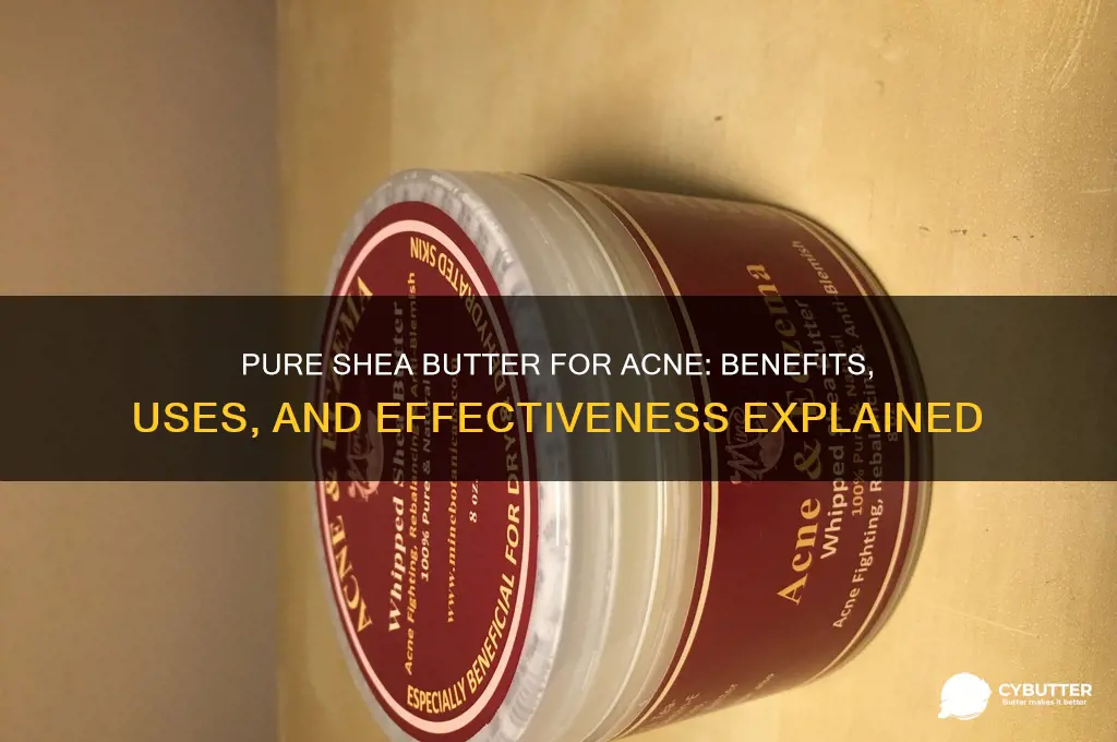 is pure shea butter good for acne