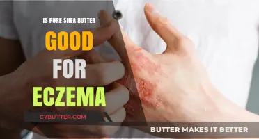 Pure Shea Butter for Eczema: Benefits, Uses, and Relief Tips
