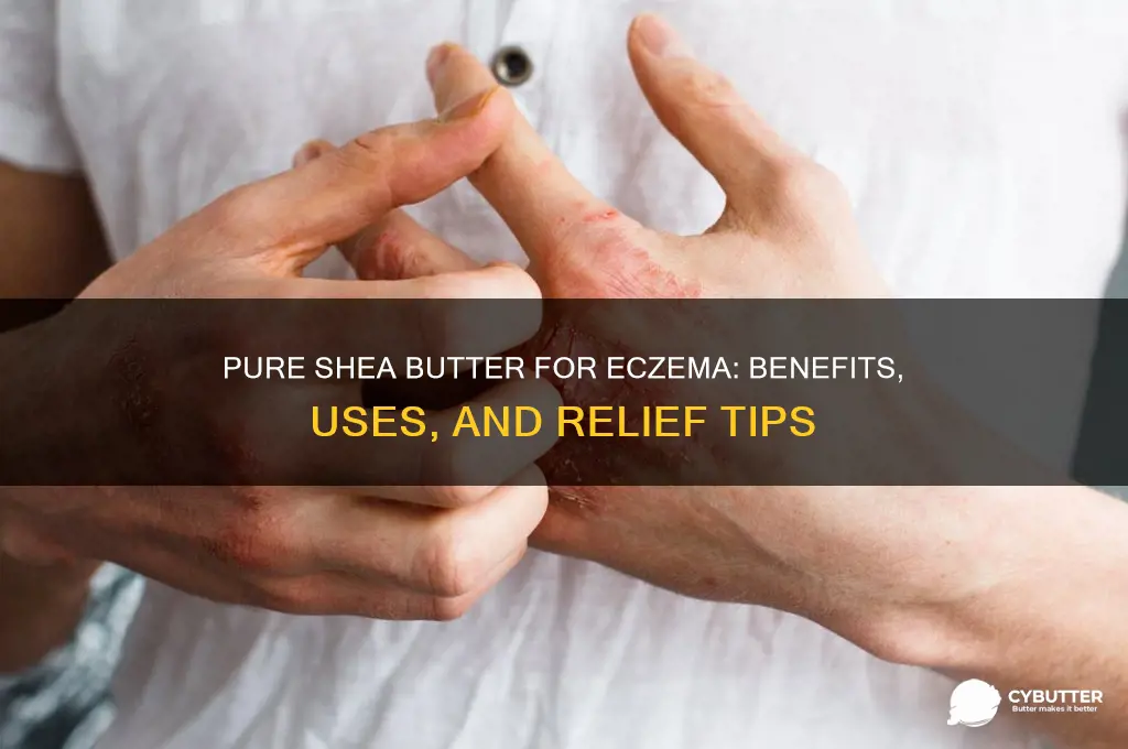 is pure shea butter good for eczema