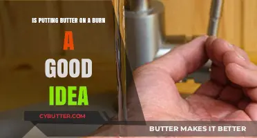 Butter on Burns: Myth or Effective Home Remedy?
