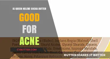 Queen Helene Cocoa Butter: Effective Acne Treatment or Myth?