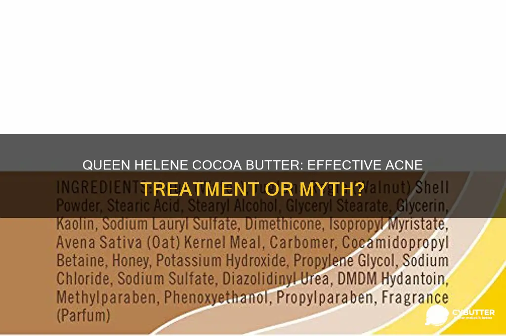 is queen helene cocoa butter good for acne