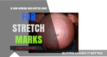 Raw African Shea Butter: Effective Stretch Mark Solution or Myth?