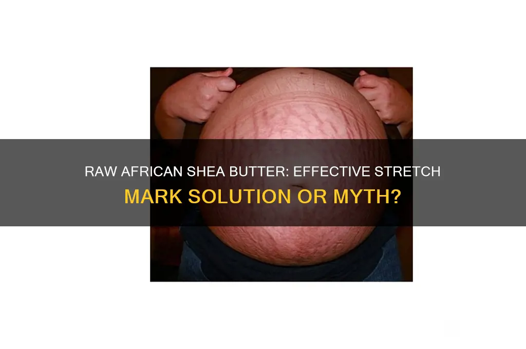 is raw african shea butter good for stretch marks