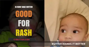Raw Shea Butter Benefits: Effective Rash Relief or Myth?