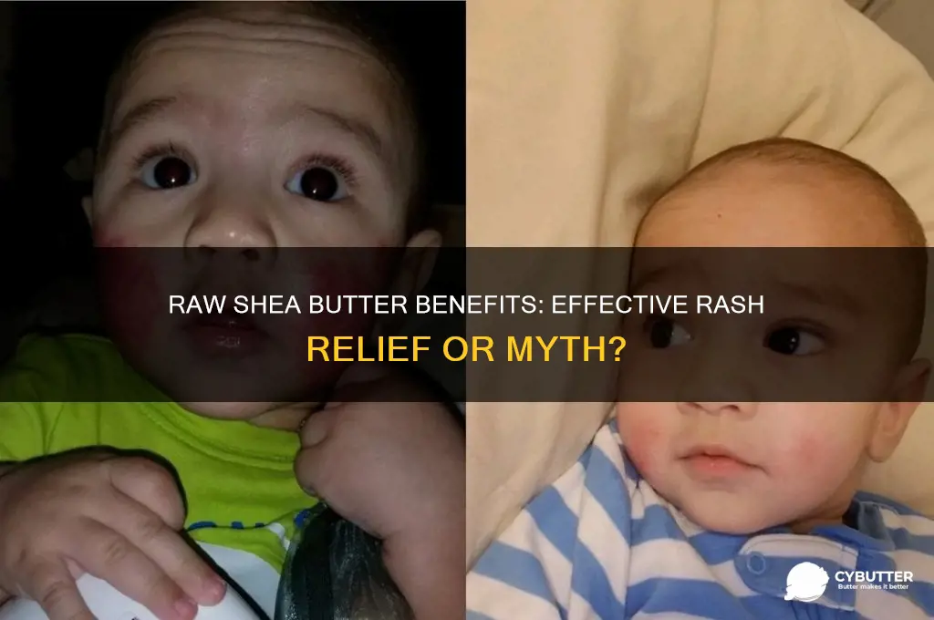 is raw shae butter good for rash