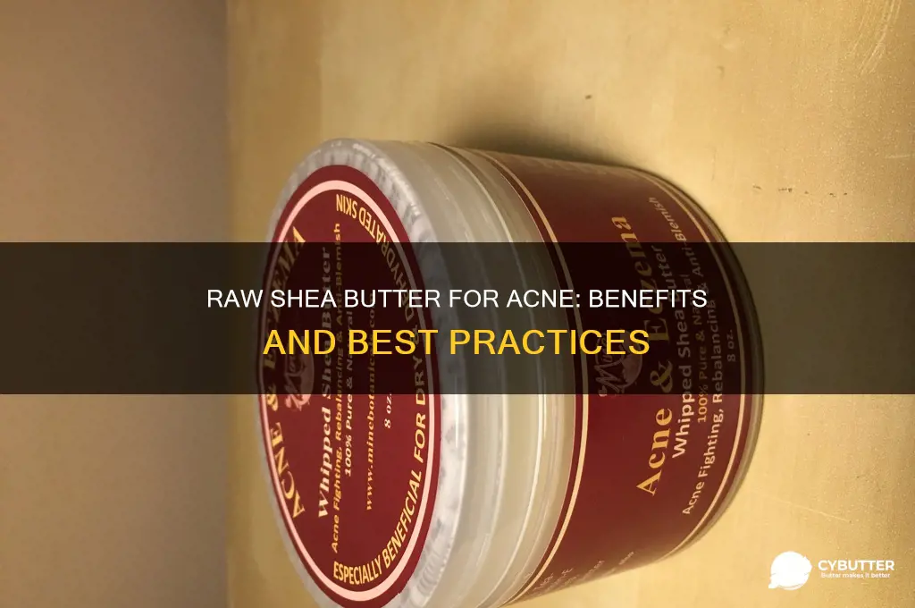 is raw shea butter good for acne prone skin