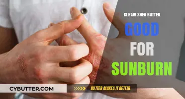 Raw Shea Butter: A Natural Remedy for Soothing Sunburn Relief?