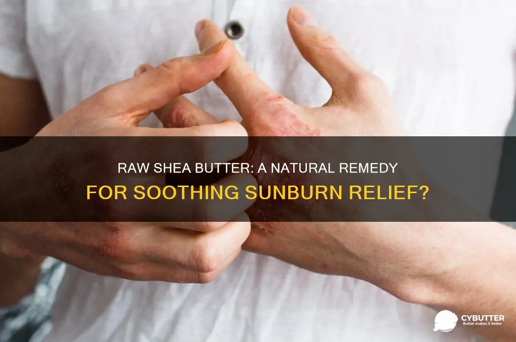 is raw shea butter good for sunburn