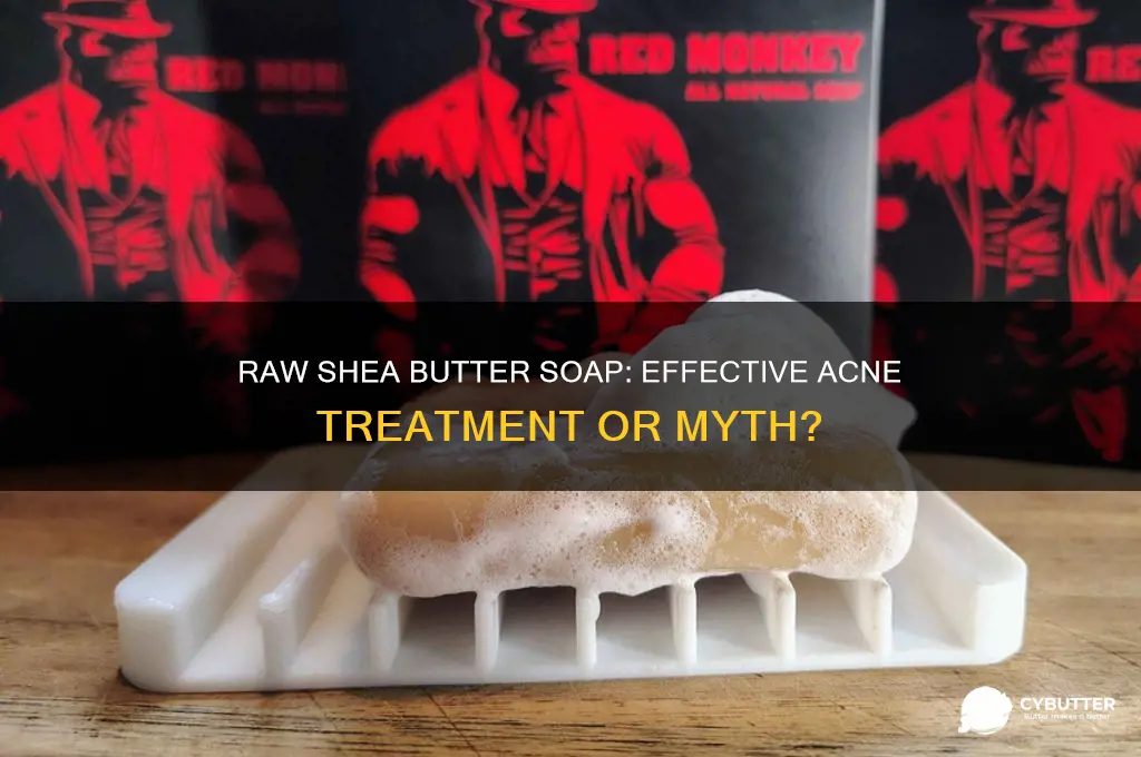 is raw shea butter soap good for acne