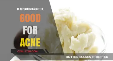 Refined Shea Butter for Acne: Benefits, Uses, and Effectiveness Explained