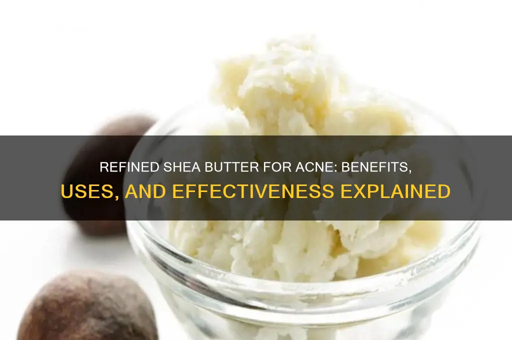 is refined shea butter good for acne
