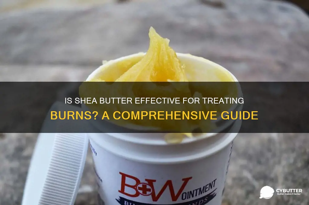 is she shea butter good for burns
