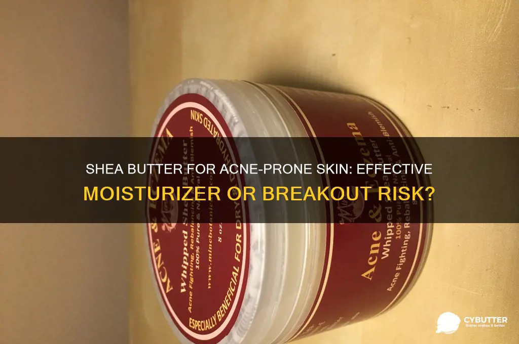 is shea butter a good moisturizer for acne prone skin