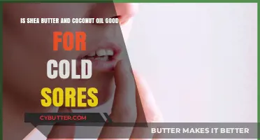 Shea Butter and Coconut Oil: Effective Remedies for Cold Sores?