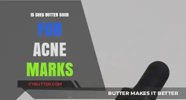 Shea Butter Benefits: Can It Fade Acne Scars and Marks?