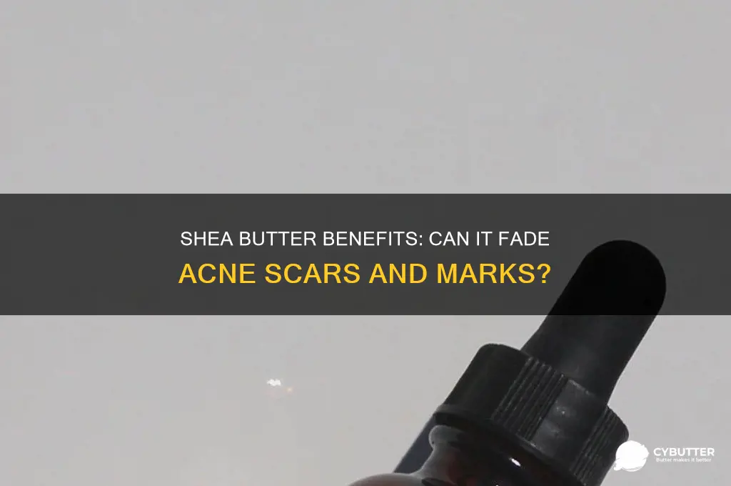 is shea butter good for acne marks