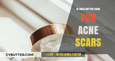 Shea Butter for Acne Scars: Effective Remedy or Myth?