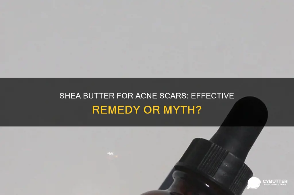 is shea butter good for acne scars