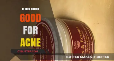Shea Butter for Acne: Benefits, Uses, and Clearing Skin Myths