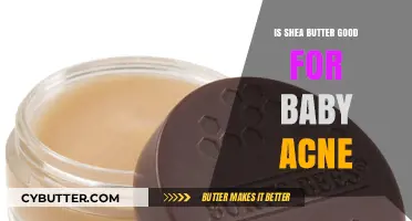 Shea Butter for Baby Acne: Gentle Solution or Myth?