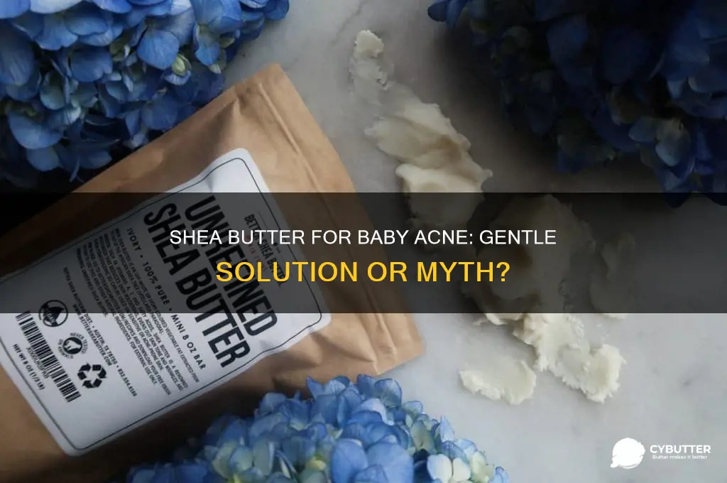 is shea butter good for baby acne