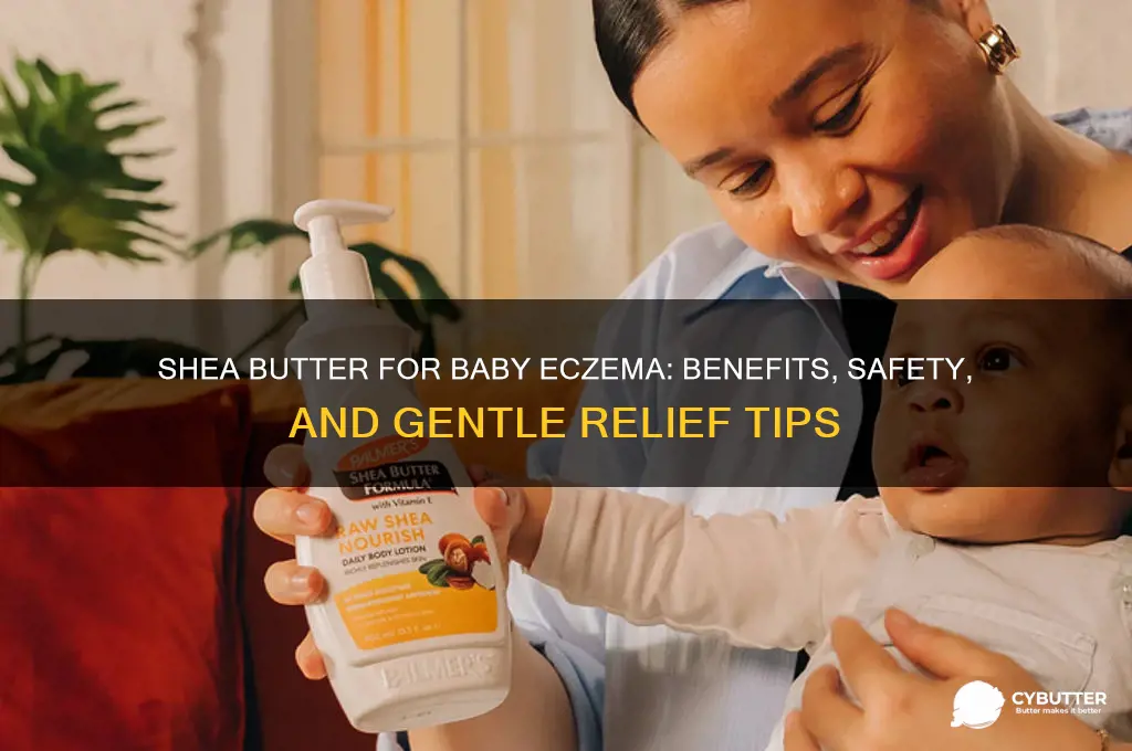 is shea butter good for baby eczema