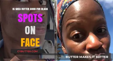 Shea Butter for Black Spots: Effective Remedy or Myth?