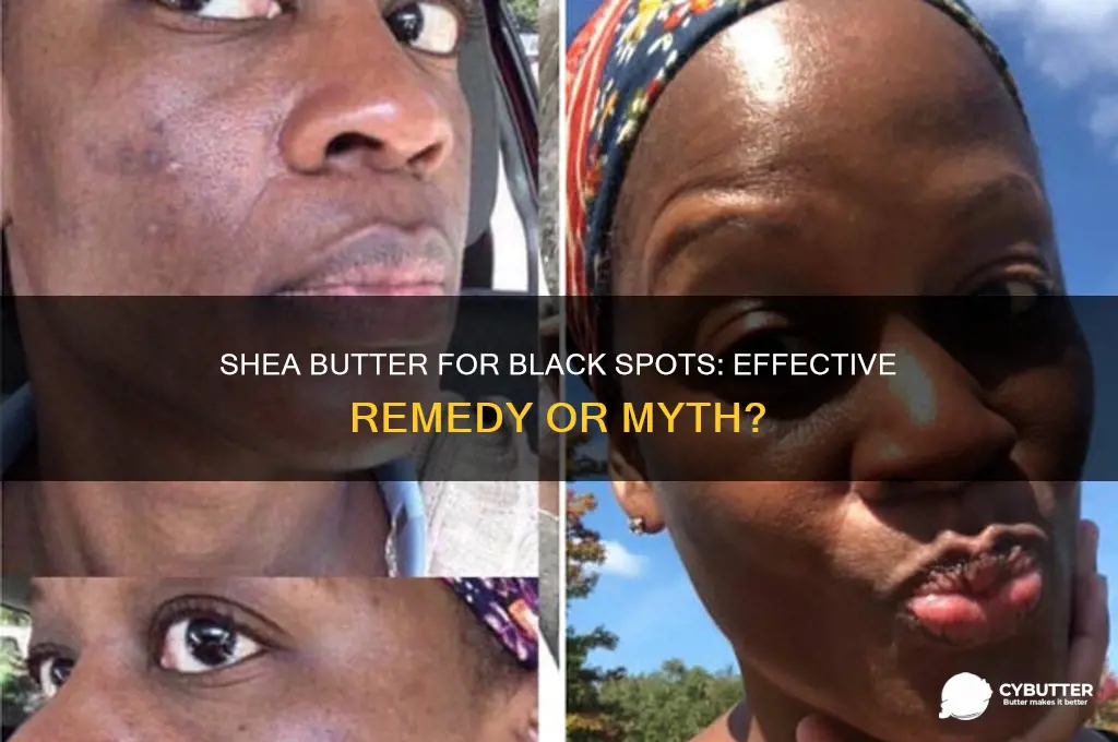 is shea butter good for black spots on face