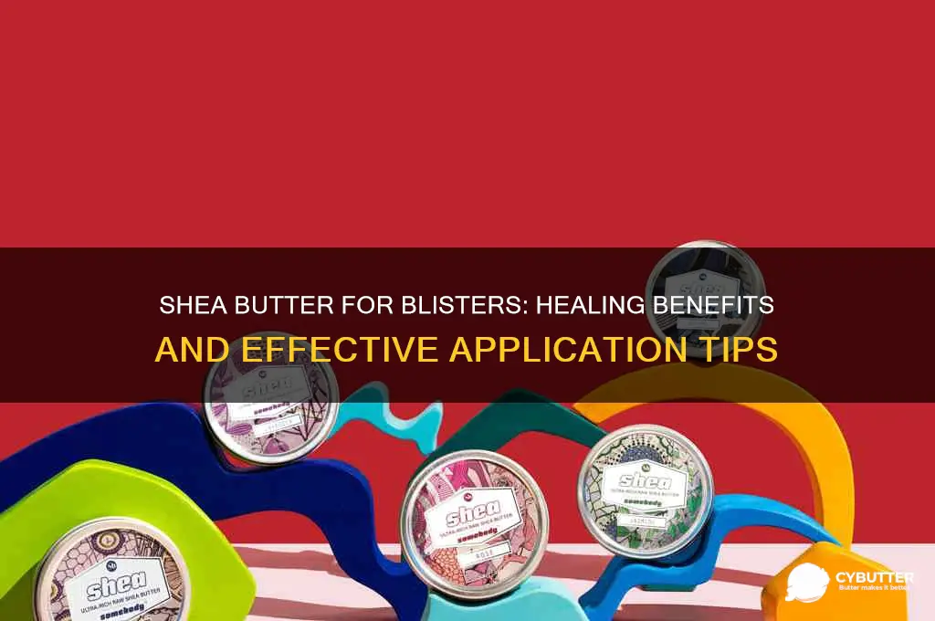 is shea butter good for blisters