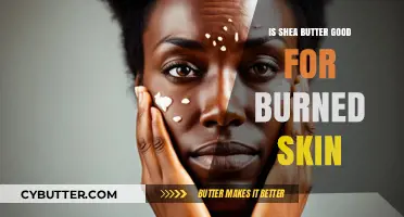 Shea Butter for Burned Skin: Healing Benefits and How to Use It