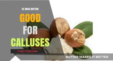 Shea Butter Benefits: Effective Callus Treatment or Just a Myth?