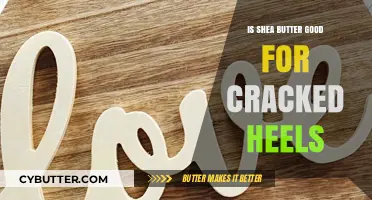 Shea Butter for Cracked Heels: Benefits and How to Use It