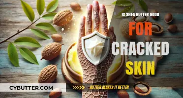 Shea Butter Benefits: Healing Cracked Skin Naturally and Effectively
