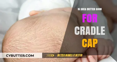 Shea Butter for Cradle Cap: Benefits, Uses, and Gentle Remedies