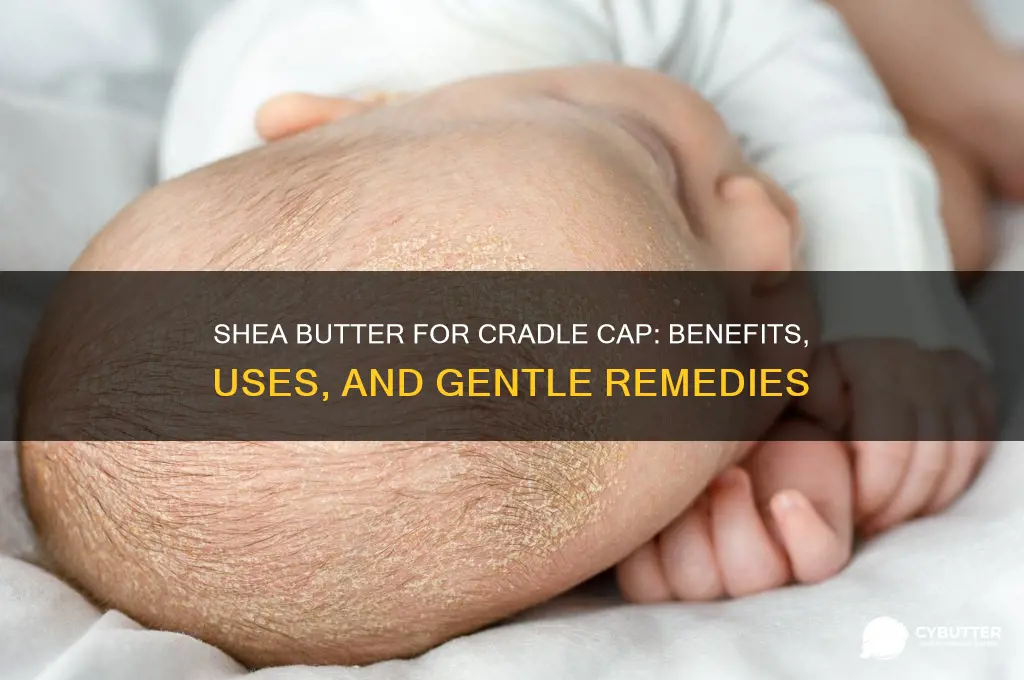 is shea butter good for cradle cap