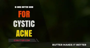 Shea Butter for Cystic Acne: Benefits, Uses, and Expert Insights