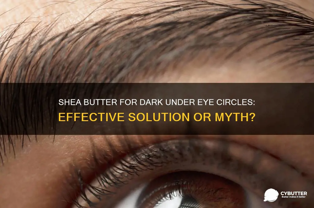 is shea butter good for dark under eye circles