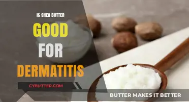 Shea Butter Benefits: Soothing Relief for Dermatitis Symptoms Explained