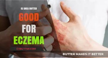 Shea Butter for Eczema: Benefits, Uses, and Relief Explained