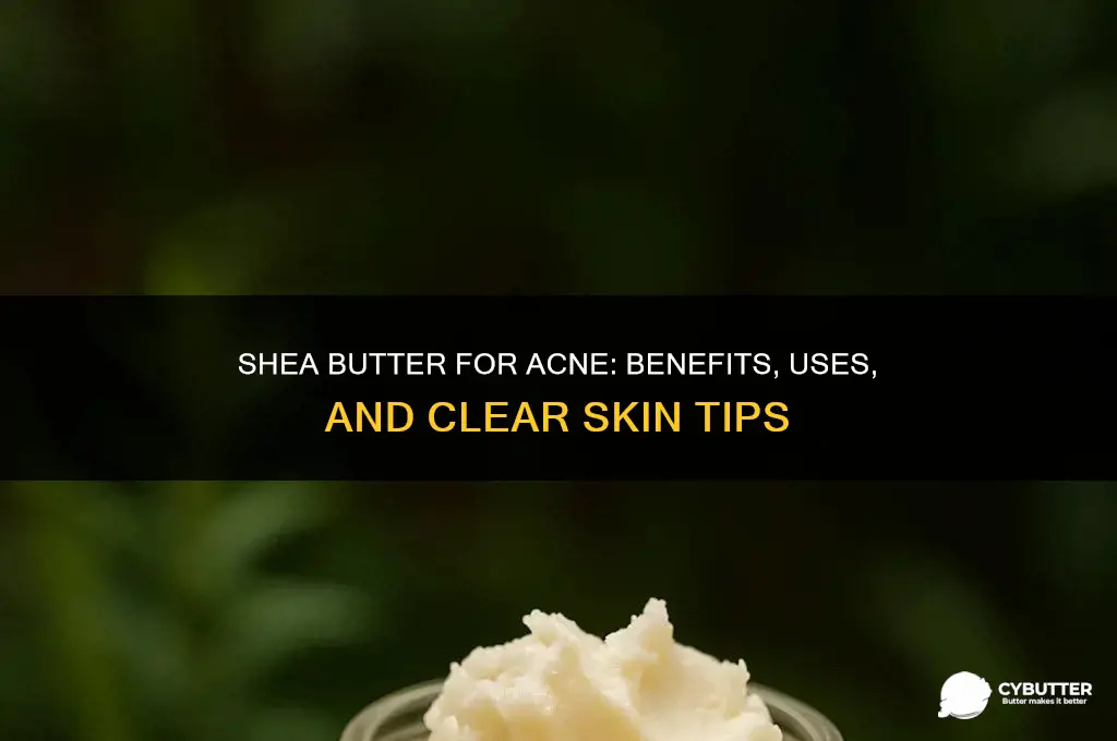 is shea butter good for face acne
