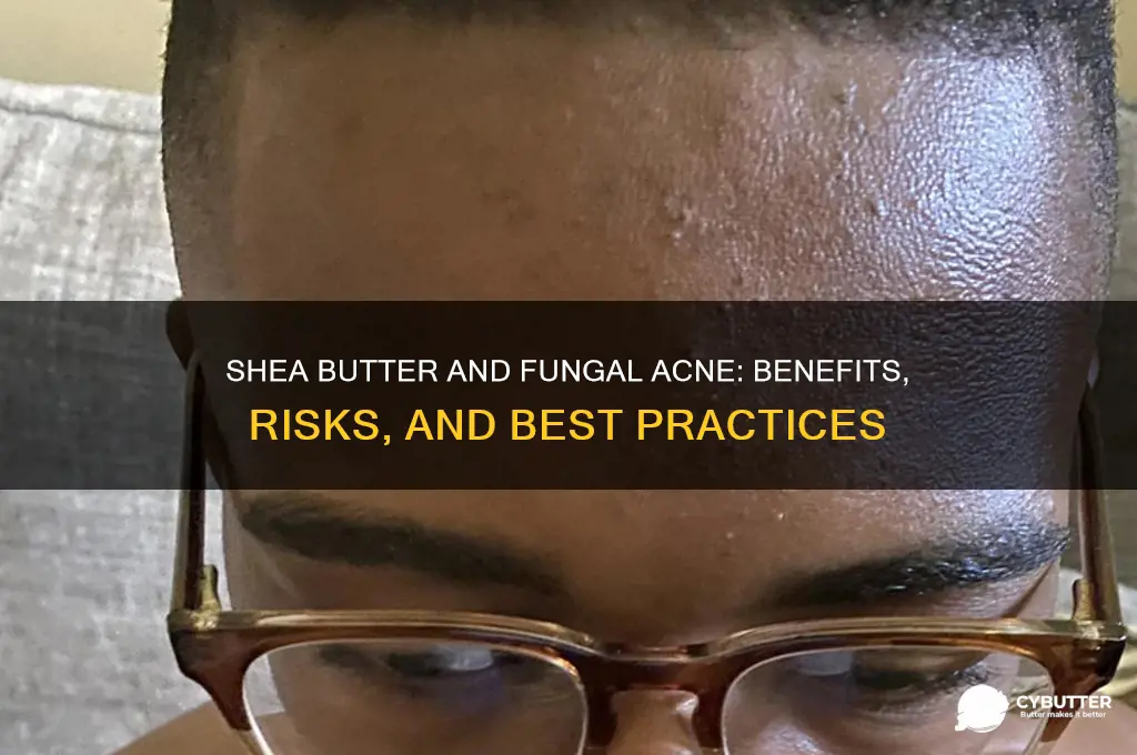 is shea butter good for fungal acne