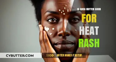 Shea Butter for Heat Rash: Effective Relief or Myth?