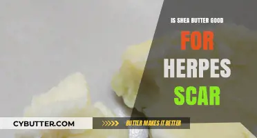 Shea Butter Benefits: Healing Herpes Scars Naturally and Effectively