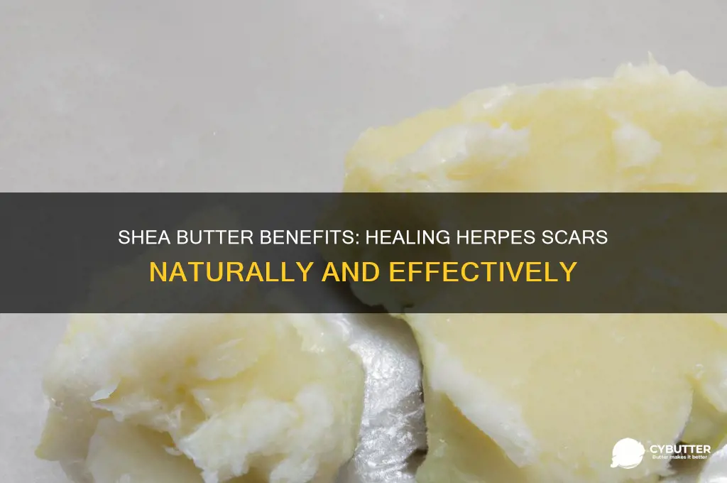 is shea butter good for herpes scar