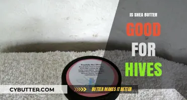 Shea Butter for Hives: Natural Relief or Skin Irritant?