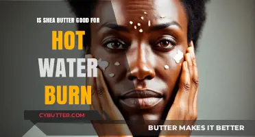 Shea Butter for Hot Water Burns: Healing Benefits and How to Use