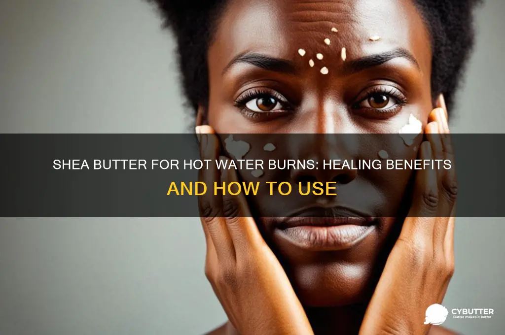 is shea butter good for hot water burn